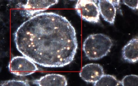 Microscopía de un filtro membrana