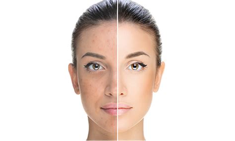 Diagrama comparativo de piel apagada vs. piel luminosa