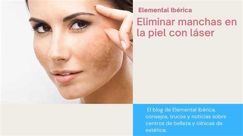 Comparativa de tratamientos para manchas en la piel