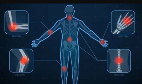 Infografía sobre la humedad y el dolor articular