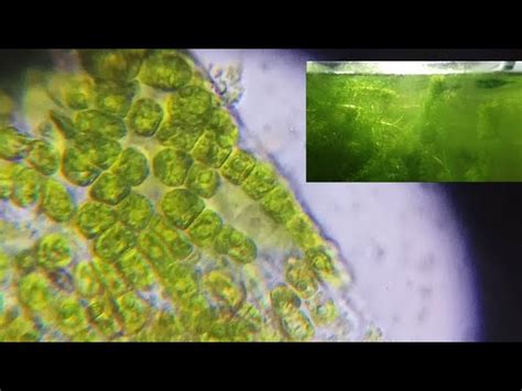 Microscopio mostrando algas en el agua