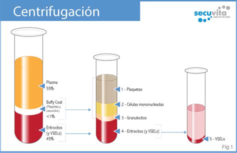 Diagrama de los métodos de clarificación del mosto: sedimentación, flotación y centrifugación