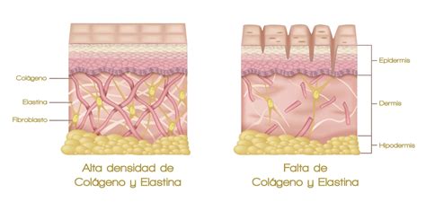 Diagrama mostrando la estructura de la piel y el efecto del colágeno