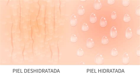 Infografía comparando piel hidratada y piel deshidratada