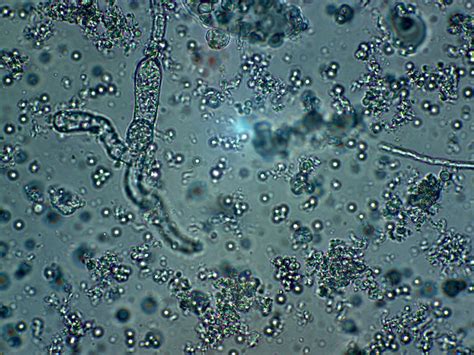 Microscopio mostrando bacterias en agua