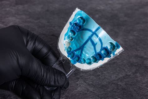 Comparación visual de impresiones dentales con siliconas de condensación y adición