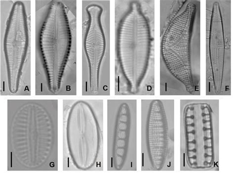 Micrografía de diatomeas