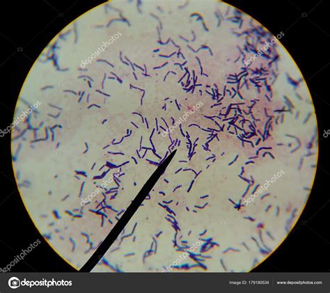 bacterias nitrificantes en un microscopio