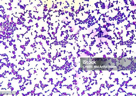 Micrografía electrónica de Staphylococcus aureus