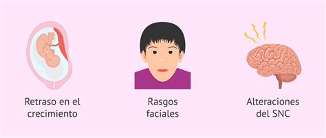 Representación del síndrome lipodistrófico en el rostro