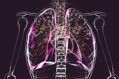 Ilustración de pulmones humanos con partículas nocivas siendo bloqueadas por un filtro respiratorio