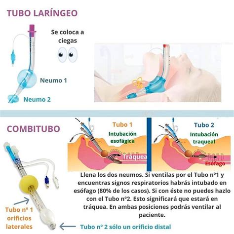 Tubo Intubador Laríngeo Fastrach y Tubo Endotraqueal asociado
