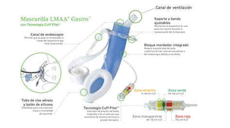 Mascarilla Laríngea con cámara integrada