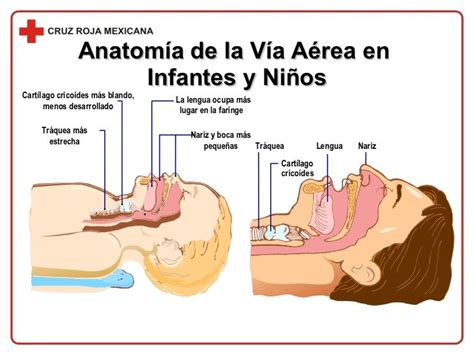 Comparación anatómica de la vía aérea pediátrica y adulta