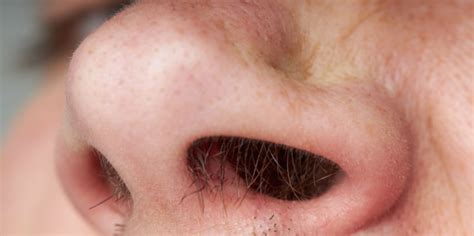 Ilustración microscópica de pelos nasales (vibrisas)