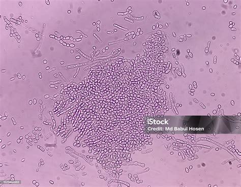 Microscopio mostrando células de Malassezia