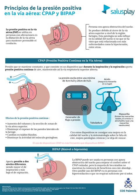 Diagrama del funcionamiento de un dispositivo CPAP