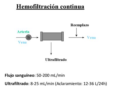 Diagrama de Hemofiltración Venovenosa Continua