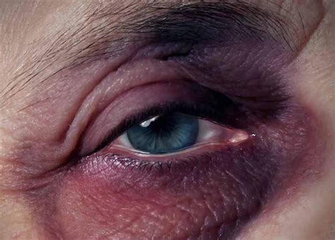 Persona con ojo morado simulado digitalmente