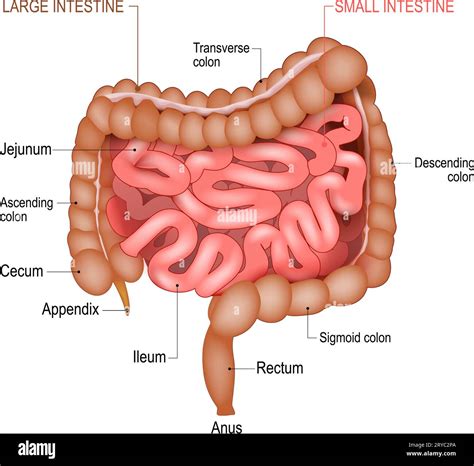 Diagrama del intestino delgado con SIBO