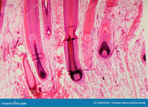 Microscopio mostrando bacterias en un folículo piloso