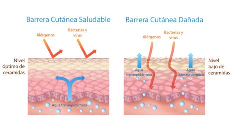 Diagrama de la barrera cutánea y cómo la psoriasis la afecta