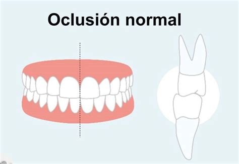 Diagrama mostrando el efecto de la oclusión de la mascarilla en la piel