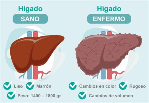Imagen conceptual de un hígado sano y vibrante