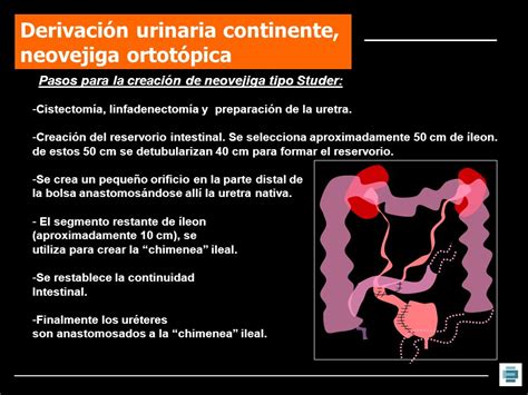 Diagrama comparativo de la derivación urinaria cutánea (urostomía) y la neovejiga