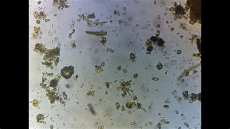 Microscopio mostrando microorganismos en agua