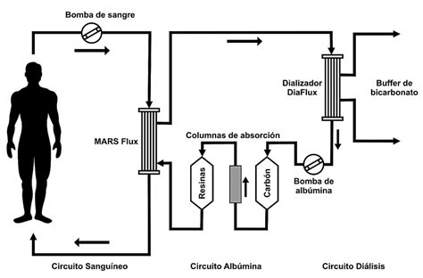 Esquema del sistema MARS