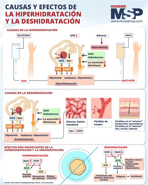 Infografía sobre las causas y efectos de la turbidez en el agua