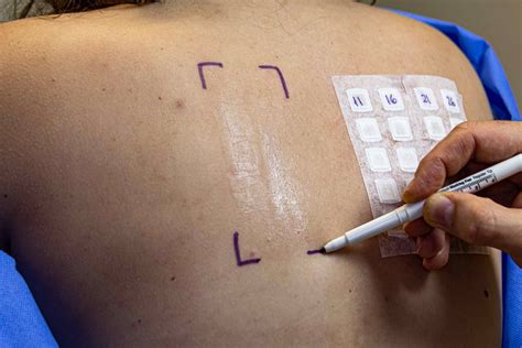 Una persona realizando una prueba de parche en su muñeca