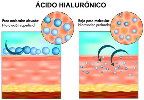Diagrama mostrando la penetración de ácido hialurónico en la piel
